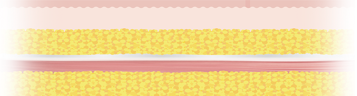 Img Product C04 Bg