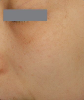 Img Product F03 2
