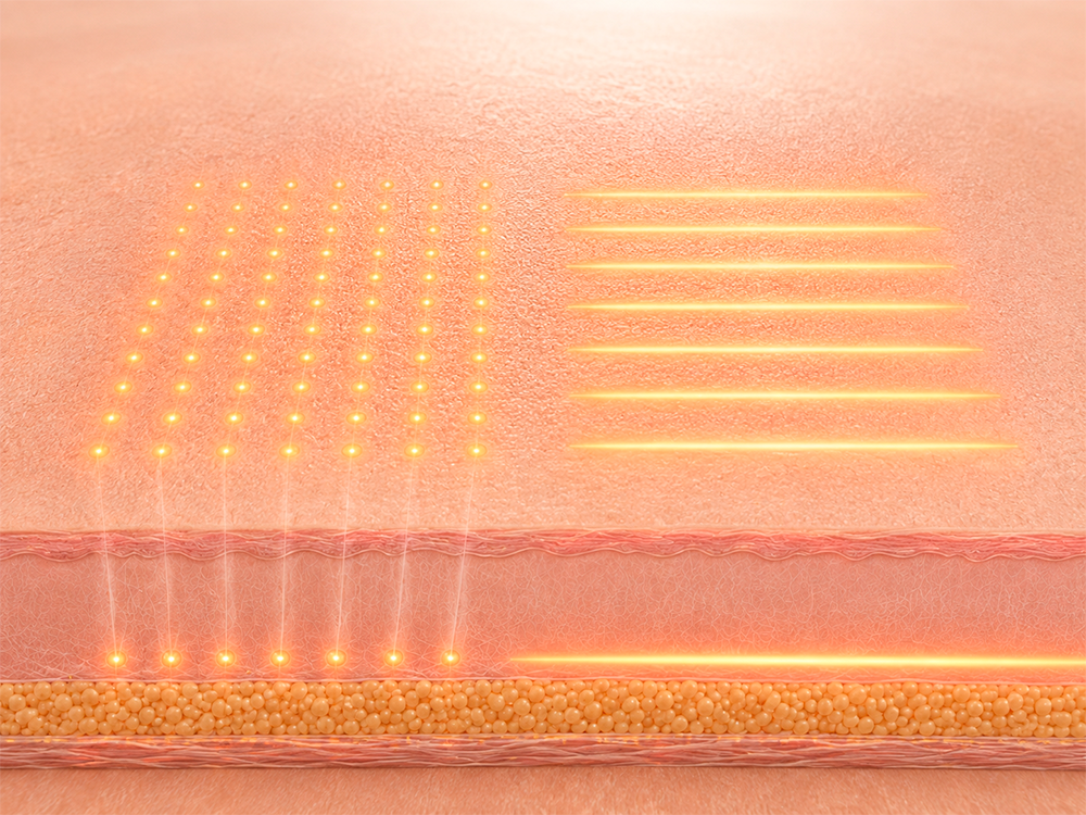 linear e dot 01